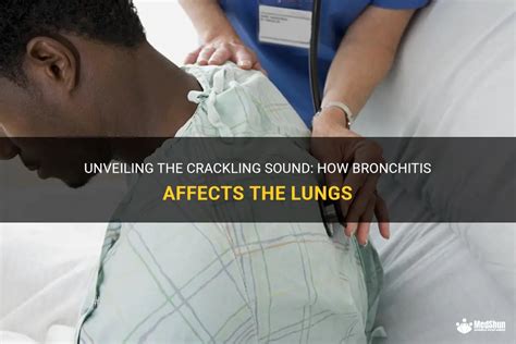 Unveiling The Crackling Sound How Bronchitis Affects The Lungs Medshun