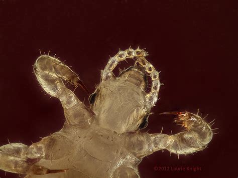 Human Head Louse Pediculus Humanus Capitis Flickr Photo Sharing