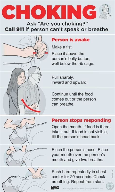 Illustrated Instructions For Someone Whos Choking Heimlich Maneuver