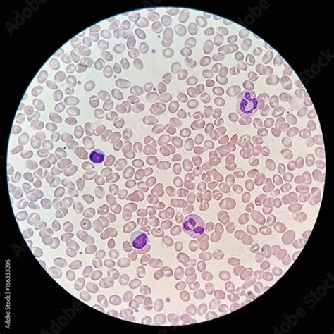 Microscope Human White Blood Cells Micropedia