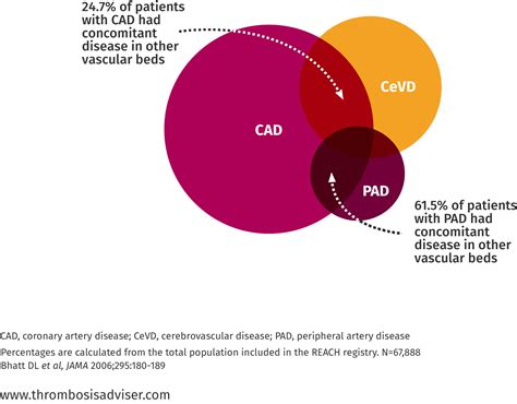 Brain attention deficit hyperactivity disorder dyslexia prefrontal cortex agy, brain png clipart. Disease clipart morbidity, Disease morbidity Transparent ...