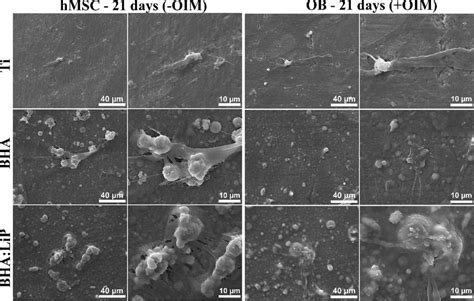 Sem Micrographs Of Human Mesenchymal Stem Cells Differentiated To