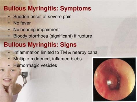 Otitis Externa