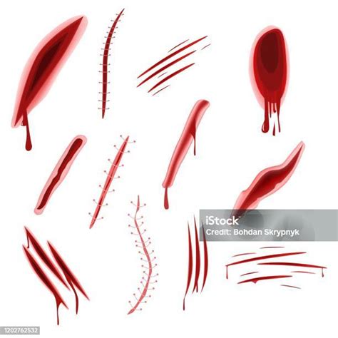 Graphic Realistic Wound Set With Blood Splash Isolated On White