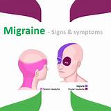 Pictures of Migraine Light Sensitivity Treatment