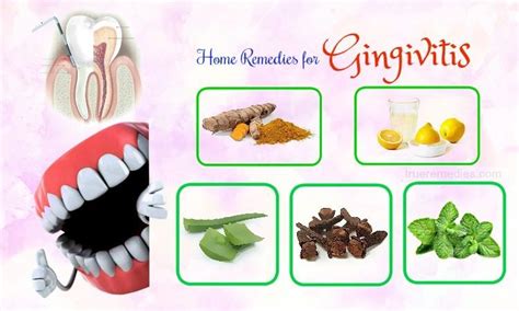 30 Natural Home Remedies For Gingivitis Pain Relief