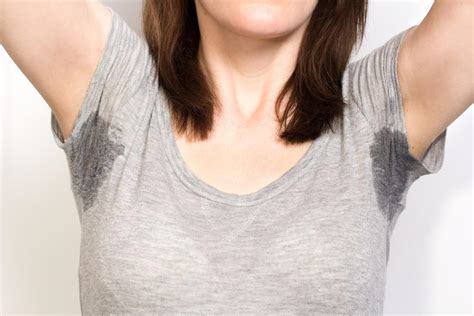 Hyperhidrosis 4 Things To Know