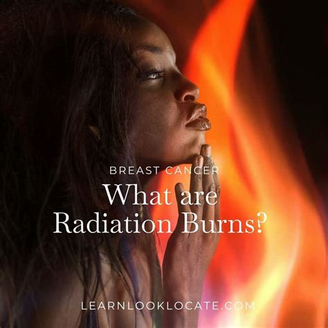 What Causes Radiation Burn Learn Look Locate