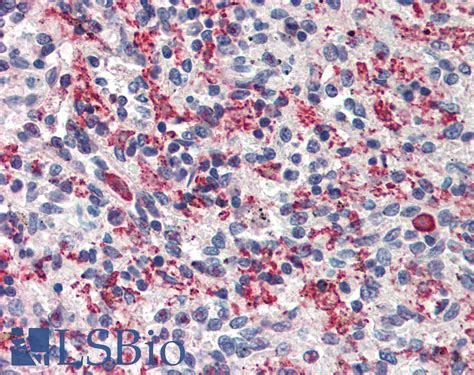 Ihc Plus Carma1 Card11 Polyclonal Antibody Rabbit Anti Human Lsbio