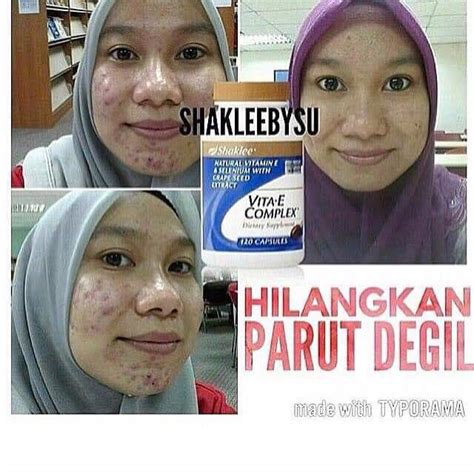 Free shaklee membership with any purchase through january 2019. Untung ambil vitamin e shaklee