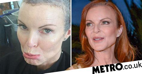Desperate Housewives Star Marcia Cross Reveals Secret Cancer Battle