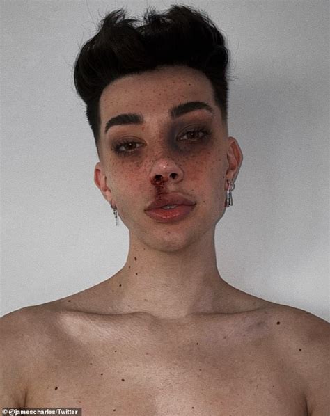 Youtuber James Charles Is Slammed For Using Makeup To Make It Look Like