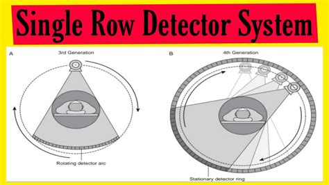 Single Row Detector System In Ct Basics Of Ct Scan Radiology