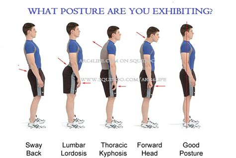 Understanding Your Posture Wellness 4 Life
