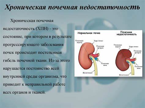 Какая диета хроническая почечная недостаточность