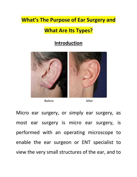Ppt Whatâ€™s The Purpose Of Ear Surgery And What Are Its Types