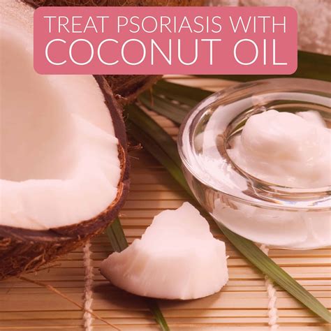 How To Treat Psoriasis With Coconut Oil