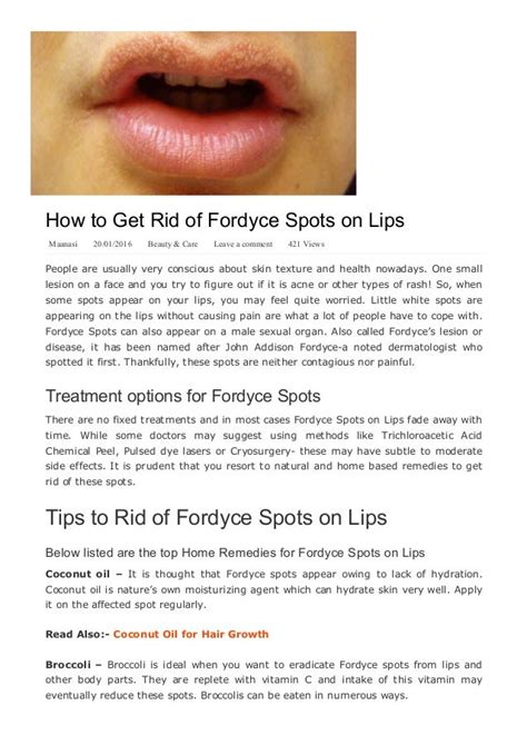 How To Get Rid Of Fordyce Spots On Lips Yabibo