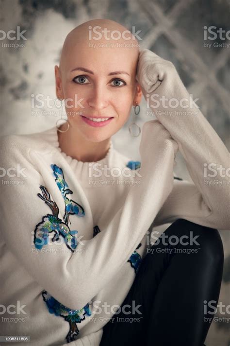 Portrait Of Beautiful Middle Woman Patient With Cancer With Shaved Head