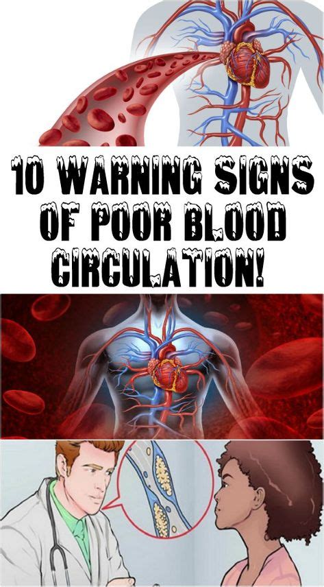 10 Warning Signs Of Poor Blood Circulation Healthy Lifestyle