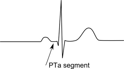 Filepta Segmentpng Ecgpedia