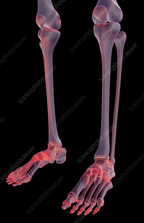 The Bones Of The Leg Stock Image F0013962 Science Photo Library