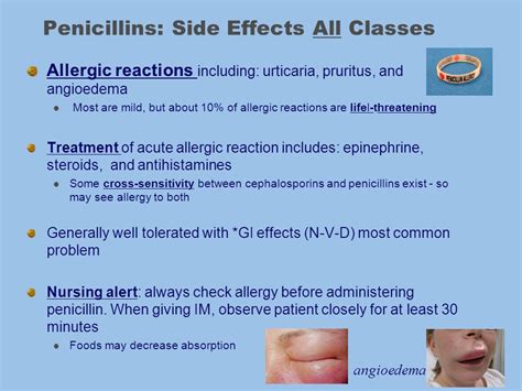 Penicillins Side Effects Antibiotic Drugs
