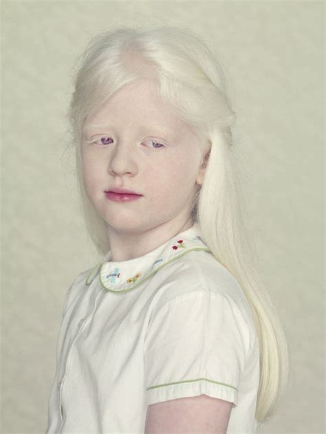 Albinos Google Search Modelo Albino Albino Girl White Blonde Hair