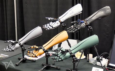 This Robotic Arm Is Part Prosthetic Part Fashion Statement