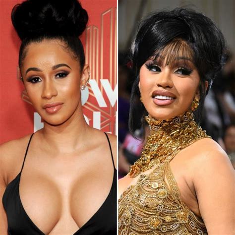 Celebrity Before And After Plastic Surgery Breast