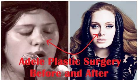 She made it abundantly clear that her weight had nothing to do with her career—she is a singer, not a playboy model. Adele Plastic Surgery Before and After Full HD - YouTube