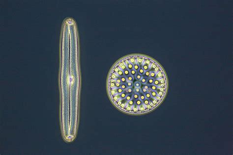 Diatoms Centric And Pennate Forms F100