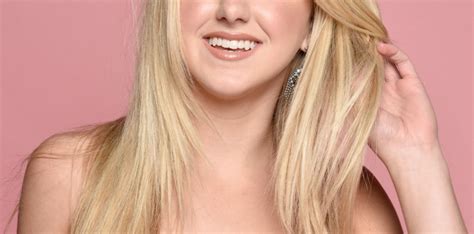 What Happened To Chloe Lukasiak Eye Condition And Whereabouts Now
