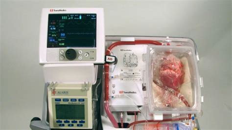 Heart Transplant Breakthrough Revives Dead Organ Before Giving Patient