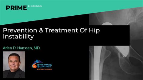 Prevention And Treatment Of Hip Instability Arlen D Hanssen Md Youtube