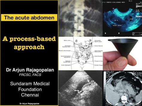 The Acute Abdomen A Process Based Approach