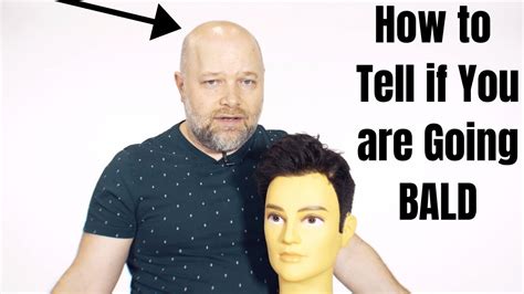 How To Tell If You Are Going Bald Thesalonguy Youtube