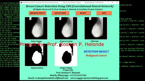 Breast Cancer Detection Using Cnn Convolutional Neural Network Python