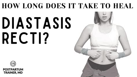 How To Fix Diastasis Recti Years Later Nhs Earth Base