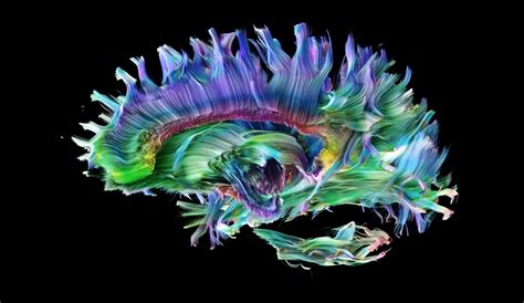 The Beauty Of Your Brain And How To See It