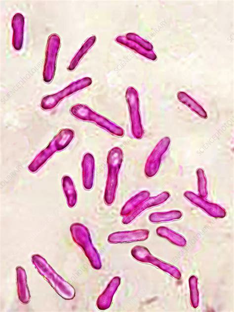 Clostridium Botulinum Stock Image C0214469 Science Photo Library