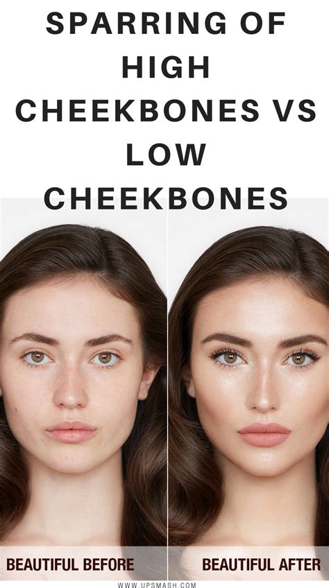 High Cheekbone Botox Before And After Women