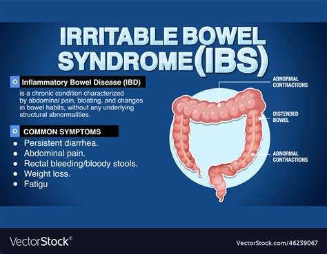 Irritable Bowel Syndrome Ibs Infographic Vector Image