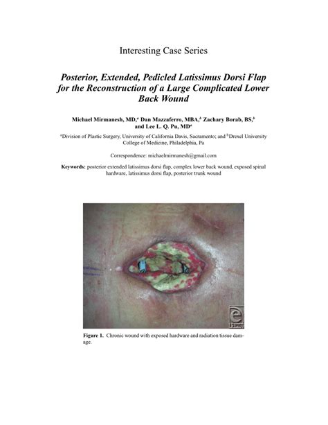 Pdf Posterior Extended Pedicled Latissimus Dorsi Flap For The