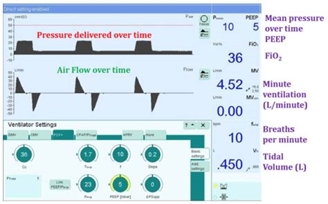 Mechanical Ventilation The Basics Covid 19 Curriculum