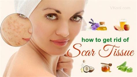 As the scars get older and become less fragile, you can apply more pressure when applying the moisturizers to help prevent scar stiffness and loosen up the area. How to get rid of scar tissue naturally - 10 tips