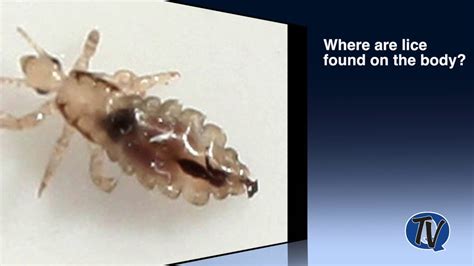 Qcsd What Does Lice Look Like Youtube