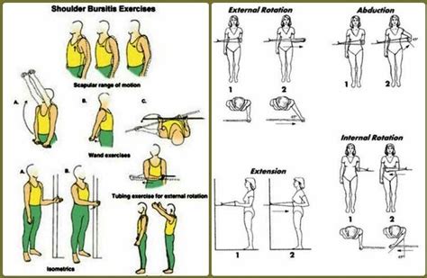 Shoulder Bursitis Treatment Exercises What Is Symptoms