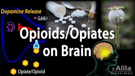 They are powerful painkillers and are commonly used to manage severe pain. Opioids Mechanism of Action, Addiction, Dependence and ...