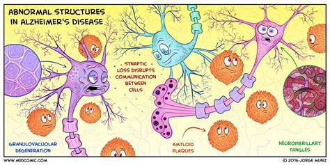 Pin On Internal Medicine